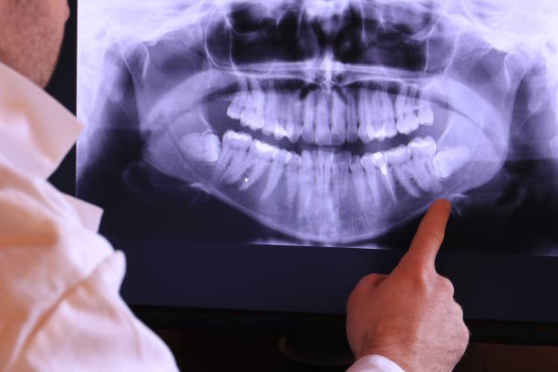 Emergency Dentist for Kids in MN